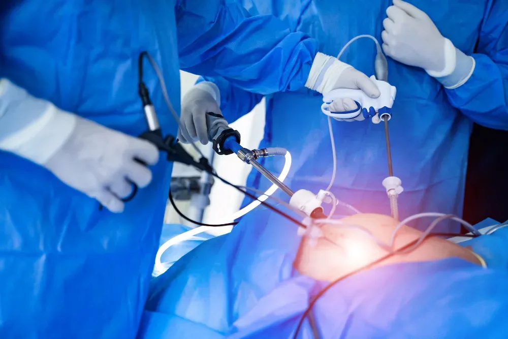 Resección de tumores del estómago y del colon por endoscopia en Puebla
